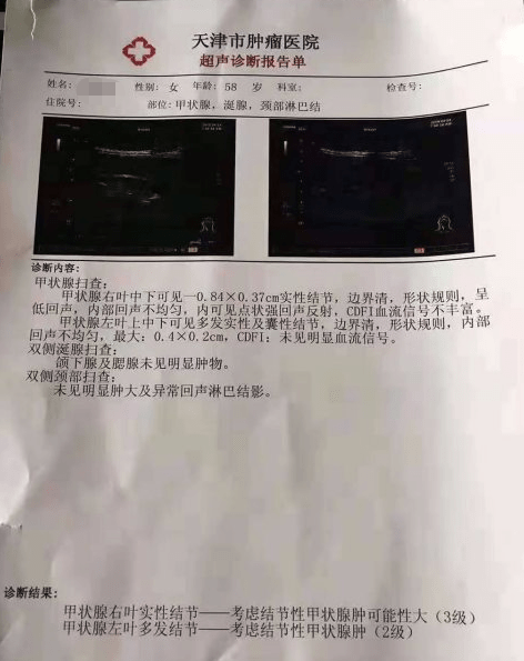 甲状腺结节怎么样治疗