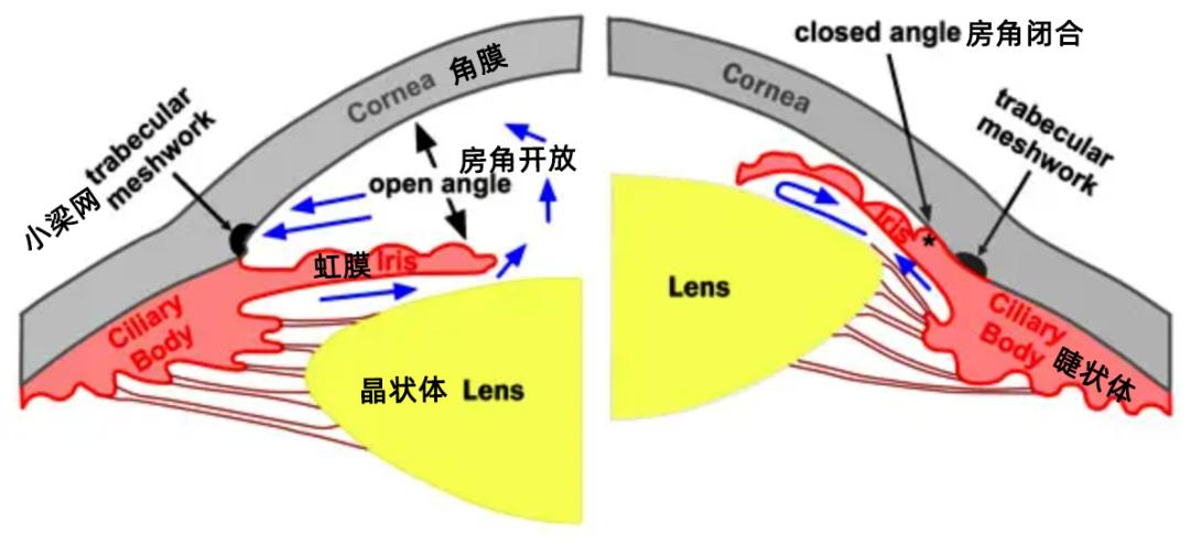 激素性青光眼是什么症状