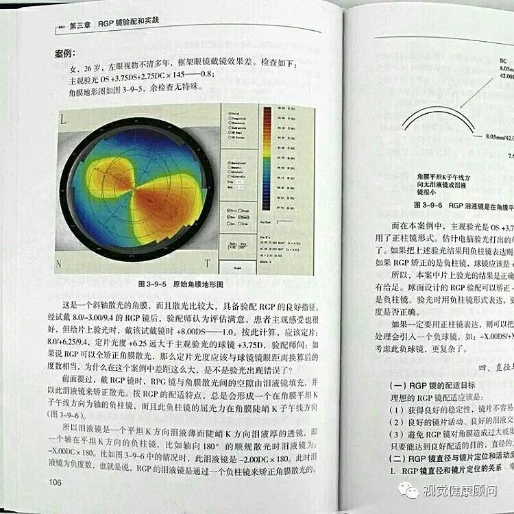 硬性角膜接触镜使用方法